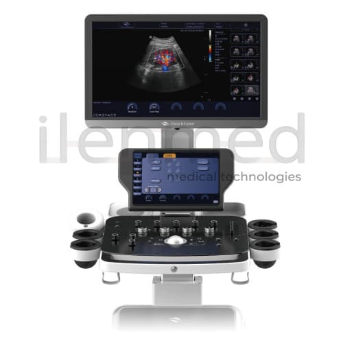 Стационарный УЗИ-аппарат Danus 10 среднего-высокого класса