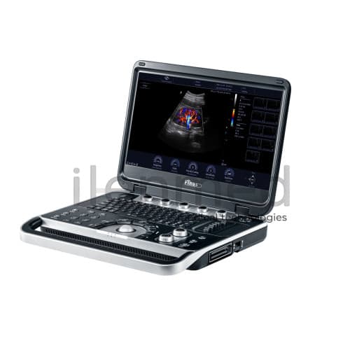 Портативная ультразвуковая диагностическая система Finus 50 с цветным доплером