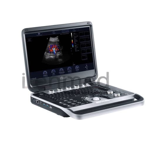 Портативная ультразвуковая диагностическая система Finus 50 с цветным доплером